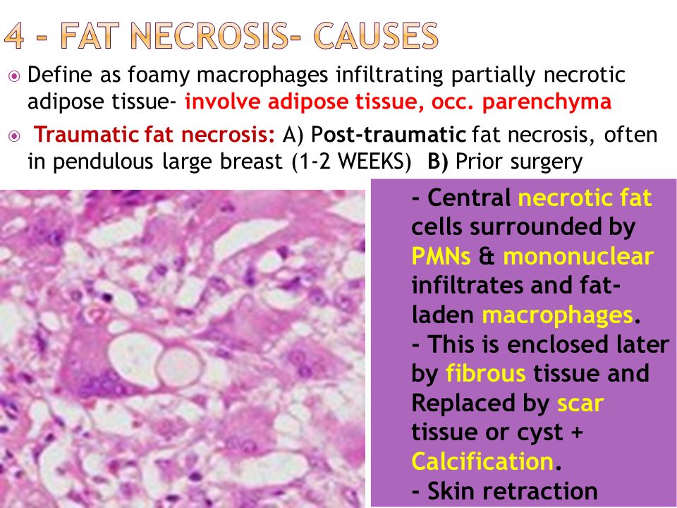 breast reasons of Loss tissue